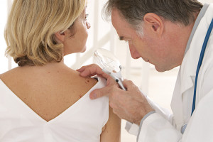 skincancer
